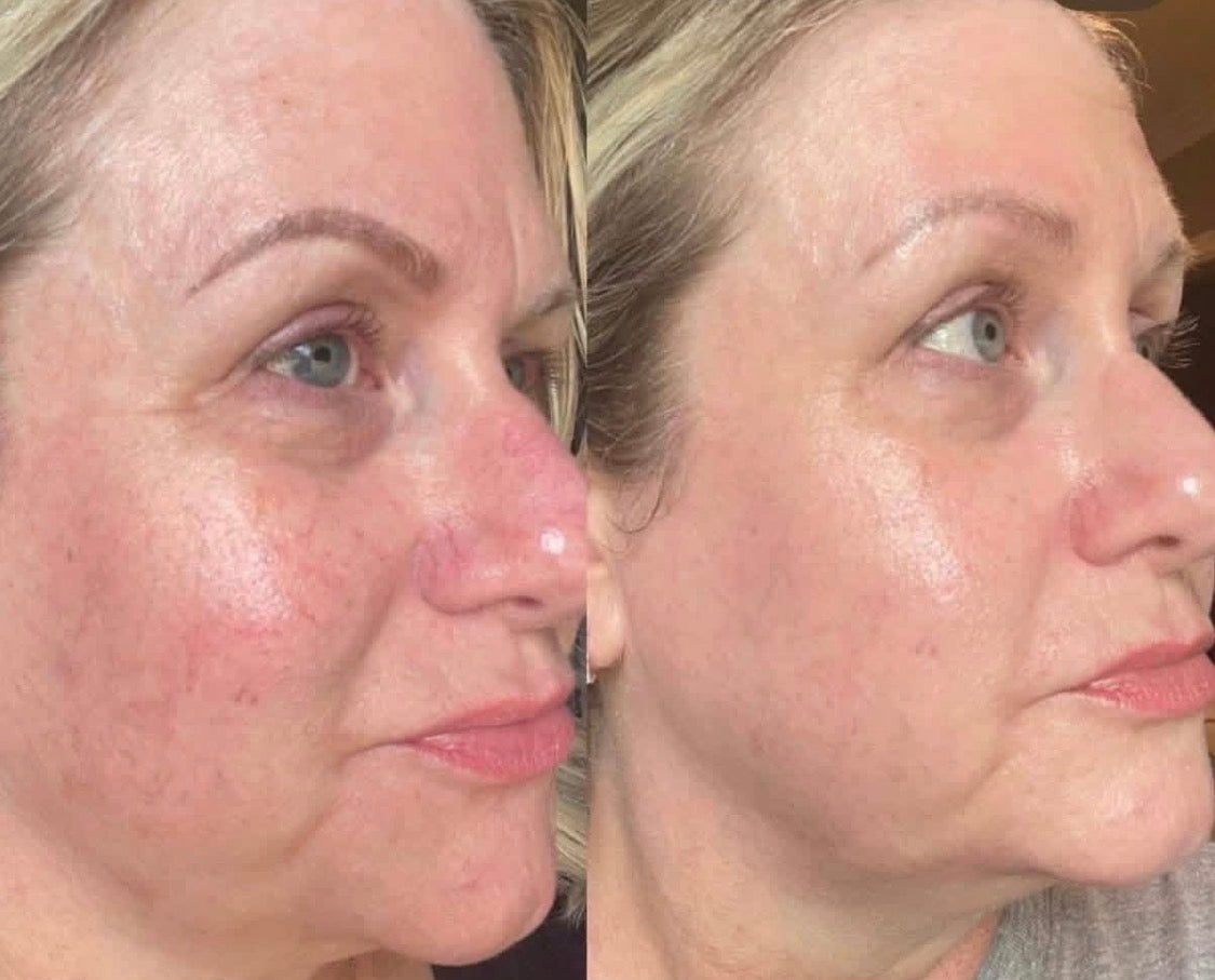 Daily Glow Kits