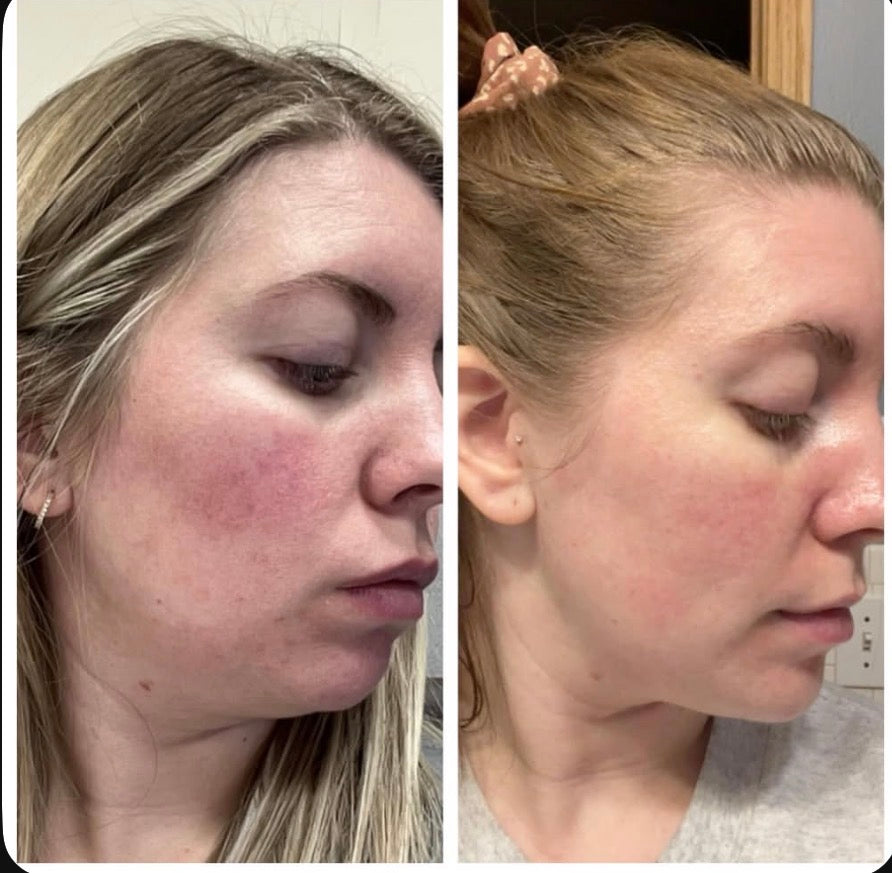 Daily Glow Kits